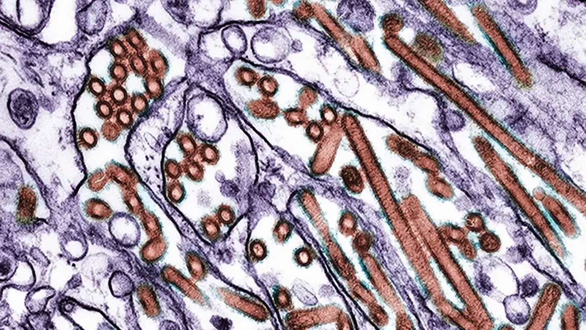 تصویر میکروسکوپی ویروس آنفولانزای پرندگان H5N1 در سلول‌ها