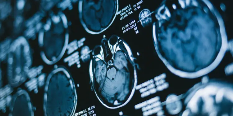 [آدوبی استاک]