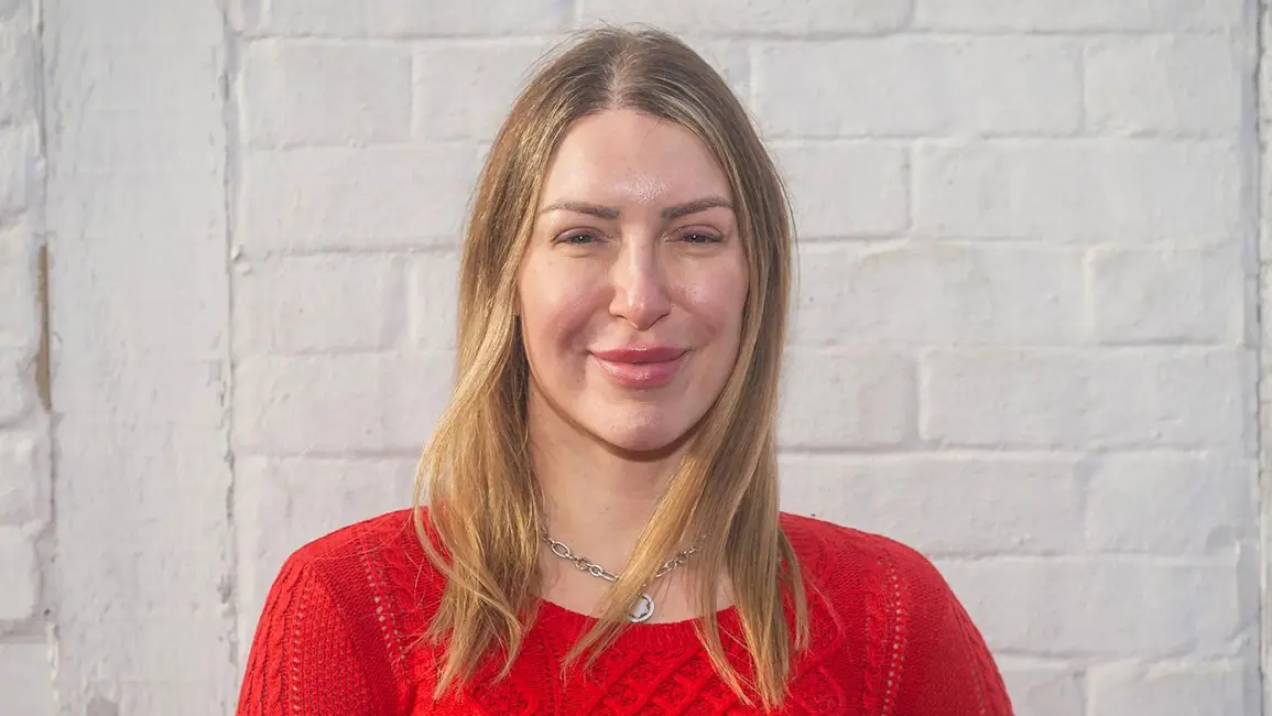 ترأسی کیس نهایتاً در سال ۲۰۲۲ پیوند مو دریافت کرد؛ ۱۱ سال پس از این‌که به او گفته شد این عمل فقط برای مردان است.