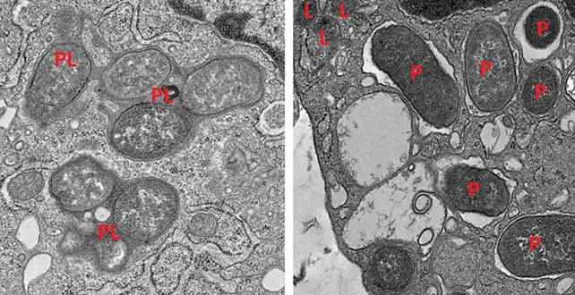 فعالیت ماکروفاژ در روده