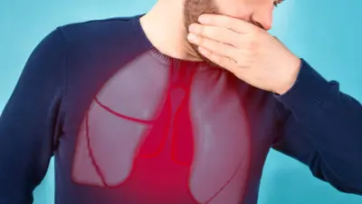 متخصصان سرطان: سرطان ریه فقط بیماری افراد سیگاری نیست و باید به علائم اولیه آن توجه کرد