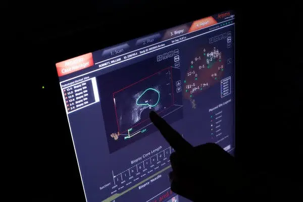 دست یک پزشک به صفحه‌نمایش کامپیوتری که اسکن پروستات بیمار را نشان می‌دهد اشاره می‌کند