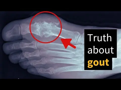 تصویر بندانگشتی یوتیوب