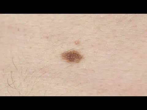 تصویر بندانگشتی یوتیوب