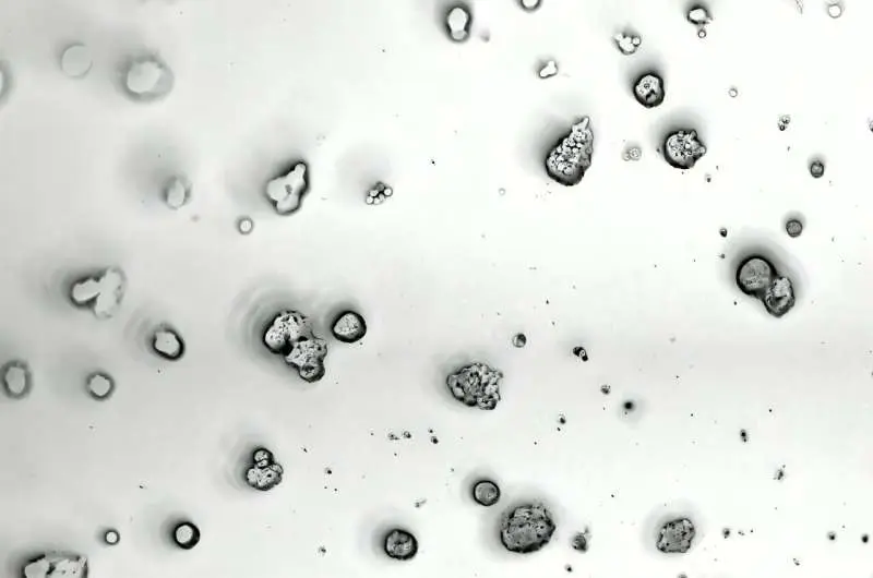 شناسایی ژن‌هایی که مانع انتشار سرطان می‌شوند