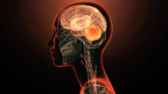 دانشمندان اولین ژن منفردی را که بهطور مستقیم باعث بیماری روانی میشود کشف کردند